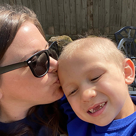 Mom kissing bald son's head